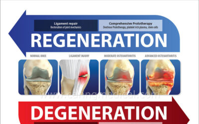 Prolotherapy Research and Treatment Guidelines