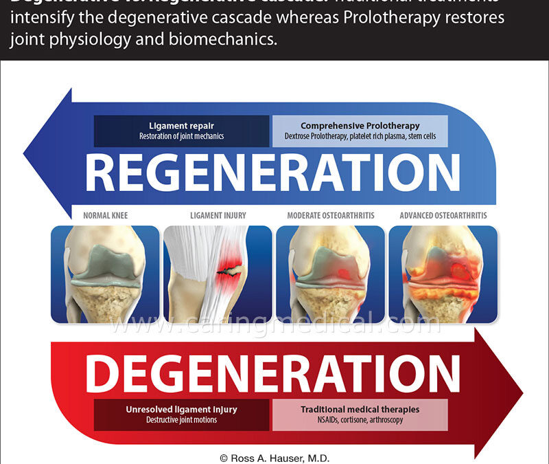 Prolotherapy research for longevity